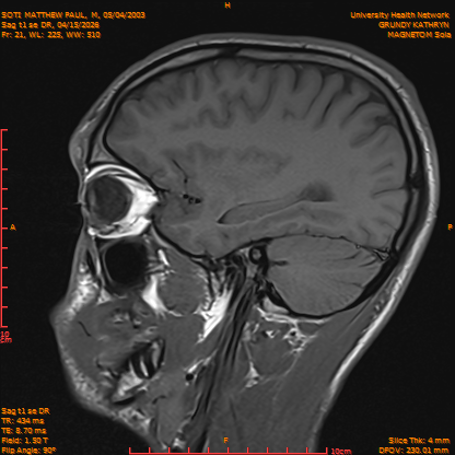 2026-04-15/Brain/Sag t1 se DR/0022-IM179.png