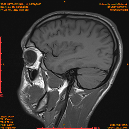 2026-04-15/Brain/Sag t1 se DR/0023-IM180.png