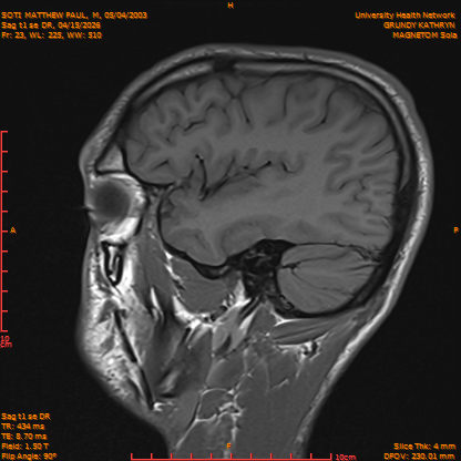 2026-04-15/Brain/Sag t1 se DR/0024-IM181.png