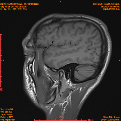 2026-04-15/Brain/Sag t1 se DR/0025-IM182.png