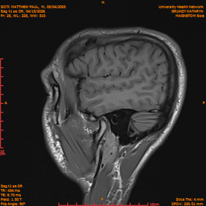 2026-04-15/Brain/Sag t1 se DR/0026-IM183.png