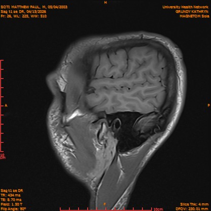 2026-04-15/Brain/Sag t1 se DR/0027-IM184.png