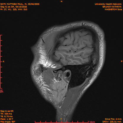 2026-04-15/Brain/Sag t1 se DR/0028-IM185.png