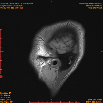 2026-04-15/Brain/Sag t1 se DR/0029-IM186.png