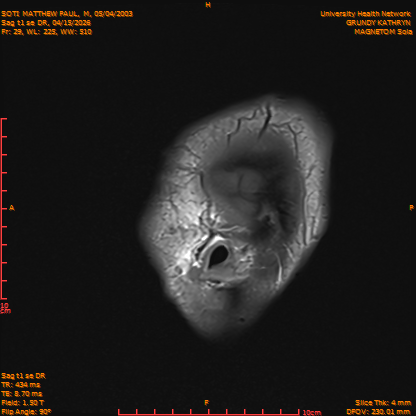 2026-04-15/Brain/Sag t1 se DR/0030-IM187.png