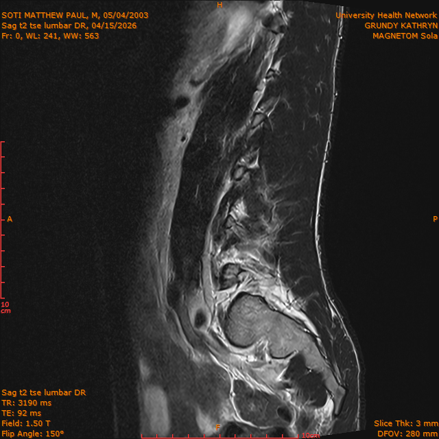 2026-04-15/Brain/Sag t2 tse lumbar DR/0001-.png