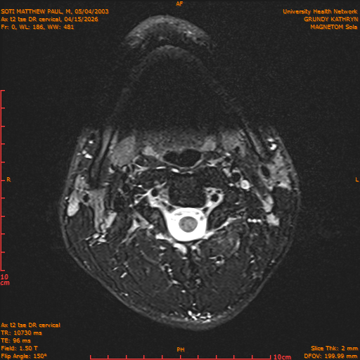 2026-04-15/Entire Spine/Aax t2 tse DR cervical/0001-.png