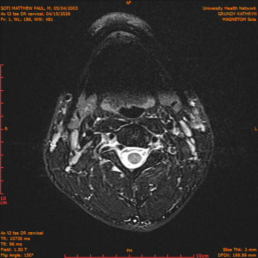 2026-04-15/Entire Spine/Aax t2 tse DR cervical/0002-.png