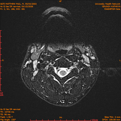 2026-04-15/Entire Spine/Aax t2 tse DR cervical/0003-.png