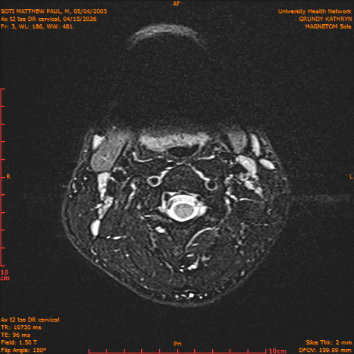 2026-04-15/Entire Spine/Aax t2 tse DR cervical/0004-.png