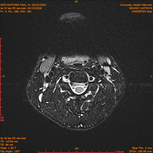 2026-04-15/Entire Spine/Aax t2 tse DR cervical/0005-.png