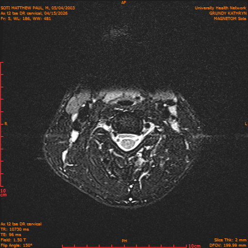 2026-04-15/Entire Spine/Aax t2 tse DR cervical/0006-.png