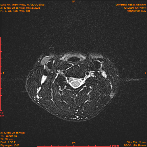 2026-04-15/Entire Spine/Aax t2 tse DR cervical/0007-.png