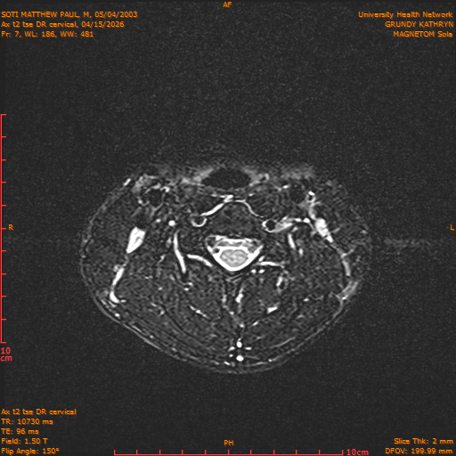 2026-04-15/Entire Spine/Aax t2 tse DR cervical/0008-.png