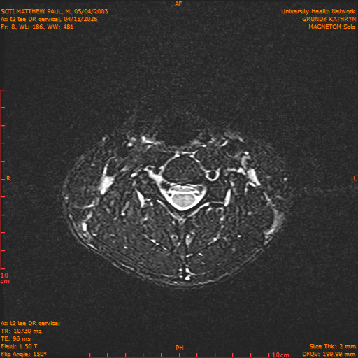2026-04-15/Entire Spine/Aax t2 tse DR cervical/0009-.png