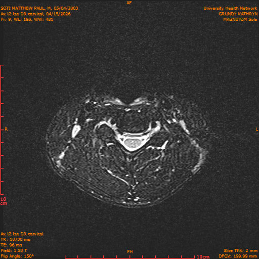 2026-04-15/Entire Spine/Aax t2 tse DR cervical/0010-.png