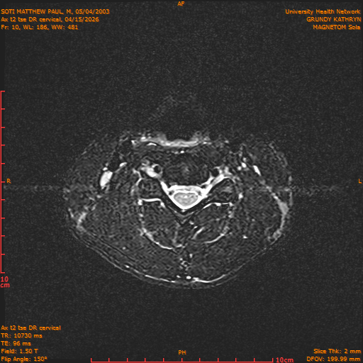 2026-04-15/Entire Spine/Aax t2 tse DR cervical/0011-.png