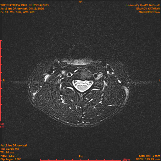 2026-04-15/Entire Spine/Aax t2 tse DR cervical/0012-.png