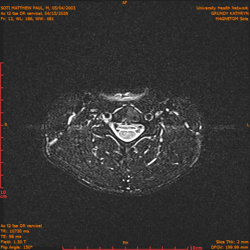 2026-04-15/Entire Spine/Aax t2 tse DR cervical/0013-.png