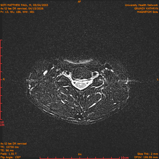 2026-04-15/Entire Spine/Aax t2 tse DR cervical/0014-.png