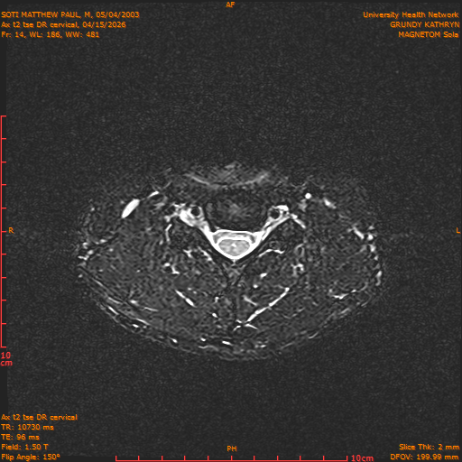 2026-04-15/Entire Spine/Aax t2 tse DR cervical/0015-.png
