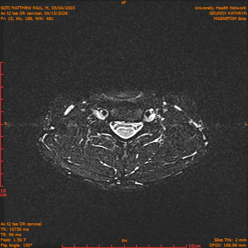 2026-04-15/Entire Spine/Aax t2 tse DR cervical/0016-.png
