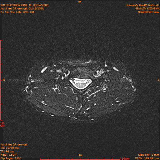 2026-04-15/Entire Spine/Aax t2 tse DR cervical/0017-.png