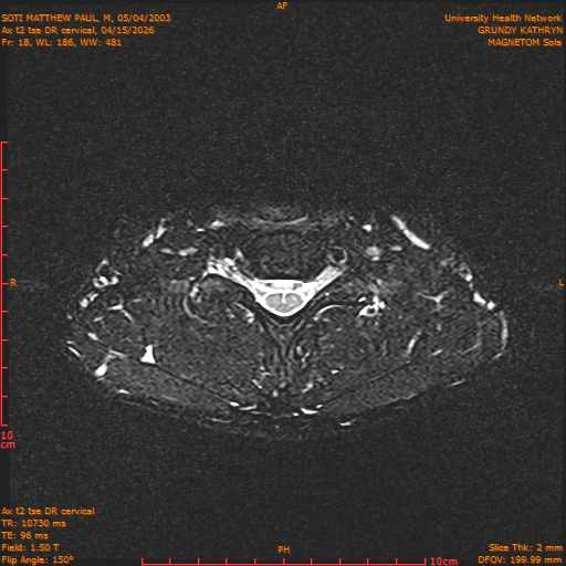 2026-04-15/Entire Spine/Aax t2 tse DR cervical/0019-.png