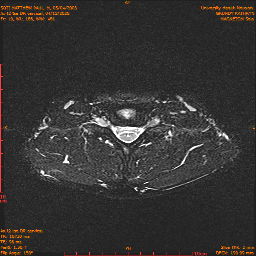 2026-04-15/Entire Spine/Aax t2 tse DR cervical/0020-.png
