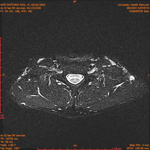 2026-04-15/Entire Spine/Aax t2 tse DR cervical/0021-.png