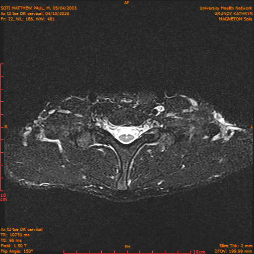 2026-04-15/Entire Spine/Aax t2 tse DR cervical/0023-.png