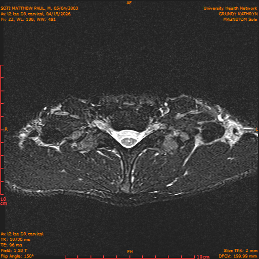 2026-04-15/Entire Spine/Aax t2 tse DR cervical/0024-.png