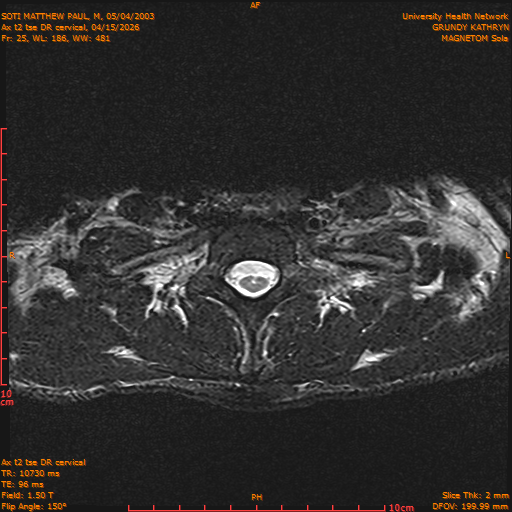 2026-04-15/Entire Spine/Aax t2 tse DR cervical/0026-.png