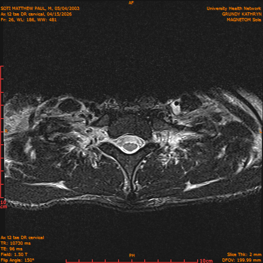 2026-04-15/Entire Spine/Aax t2 tse DR cervical/0027-.png
