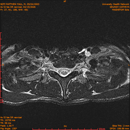 2026-04-15/Entire Spine/Aax t2 tse DR cervical/0028-.png