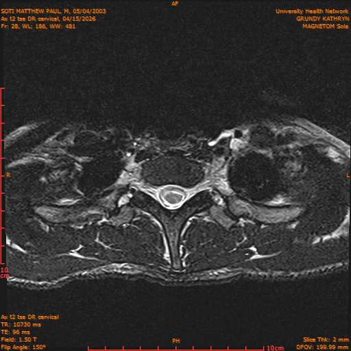 2026-04-15/Entire Spine/Aax t2 tse DR cervical/0029-.png