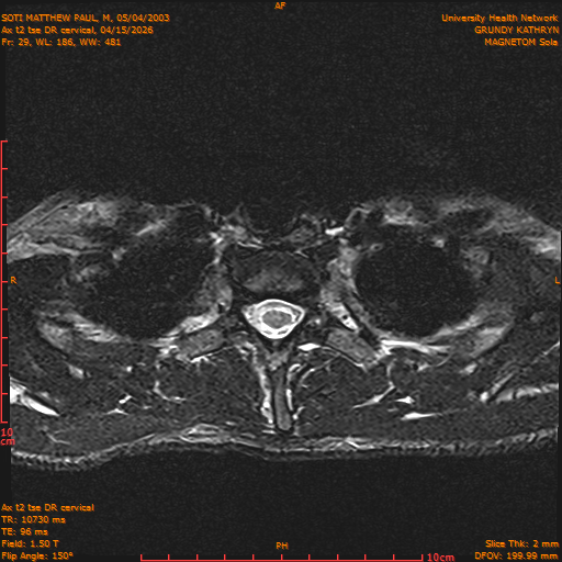2026-04-15/Entire Spine/Aax t2 tse DR cervical/0030-.png