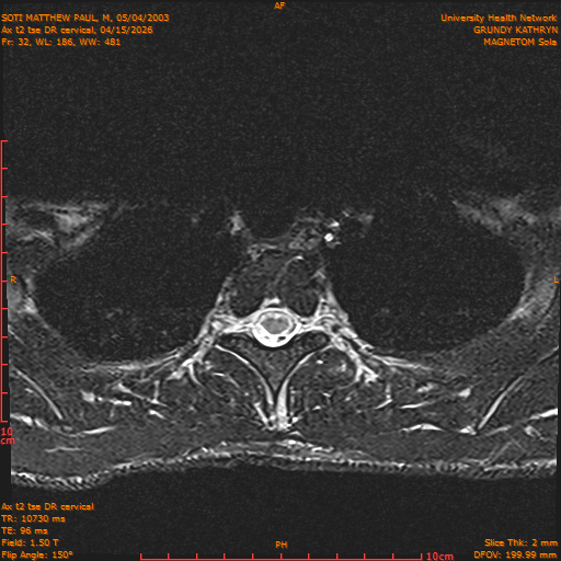 2026-04-15/Entire Spine/Aax t2 tse DR cervical/0033-.png