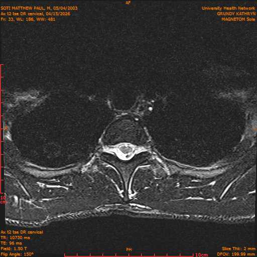 2026-04-15/Entire Spine/Aax t2 tse DR cervical/0034-.png