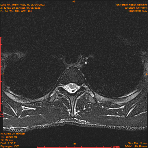 2026-04-15/Entire Spine/Aax t2 tse DR cervical/0035-.png