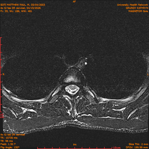2026-04-15/Entire Spine/Aax t2 tse DR cervical/0036-.png