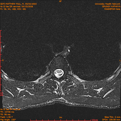 2026-04-15/Entire Spine/Aax t2 tse DR cervical/0037-.png