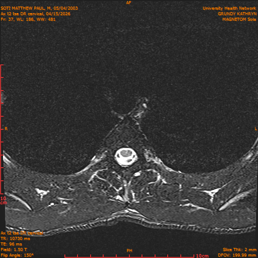 2026-04-15/Entire Spine/Aax t2 tse DR cervical/0038-.png