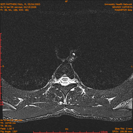 2026-04-15/Entire Spine/Aax t2 tse DR cervical/0039-.png