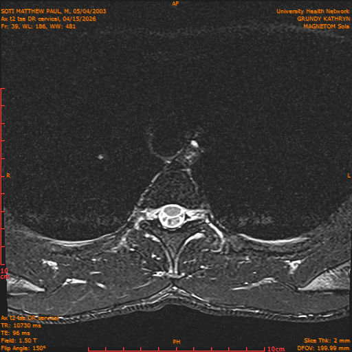 2026-04-15/Entire Spine/Aax t2 tse DR cervical/0040-.png