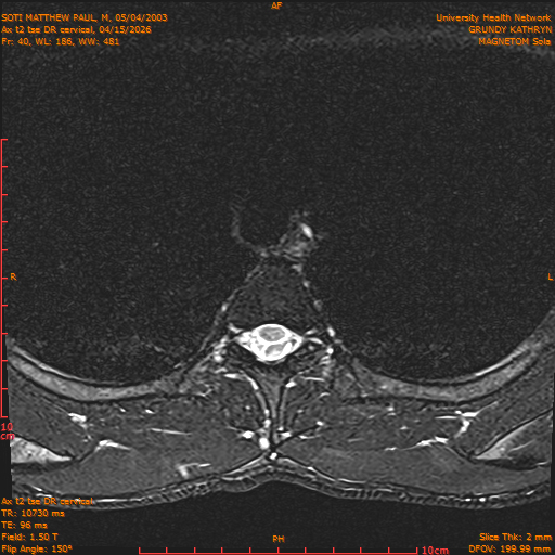 2026-04-15/Entire Spine/Aax t2 tse DR cervical/0041-.png