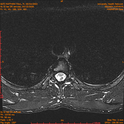2026-04-15/Entire Spine/Aax t2 tse DR cervical/0042-.png