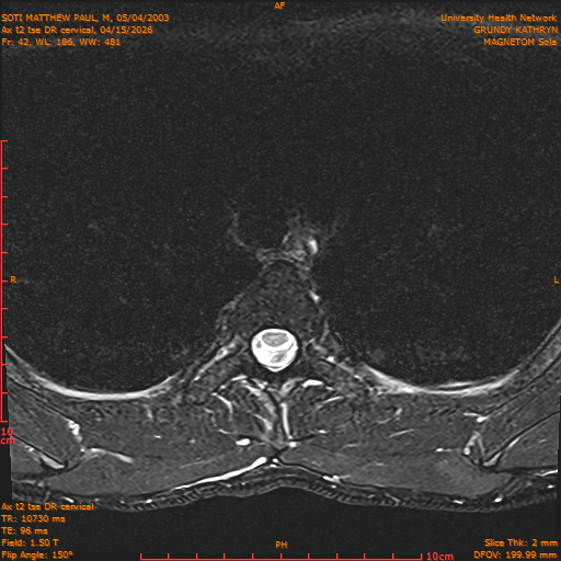 2026-04-15/Entire Spine/Aax t2 tse DR cervical/0043-.png