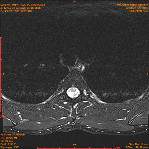 2026-04-15/Entire Spine/Aax t2 tse DR cervical/0044-.png