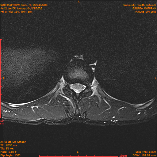 2026-04-15/Entire Spine/Ax t2 tse DR lumbar/0001-IM111.png